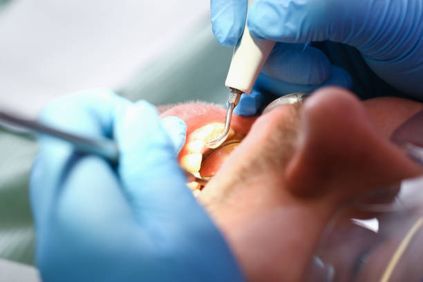 Best Emergency Tooth Extraction  in Jonesville, NC