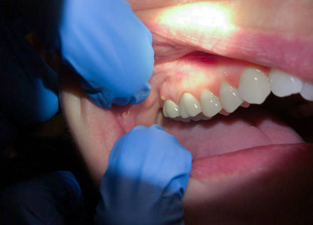 Best Urgent Tooth Repair  in Jonesville, NC