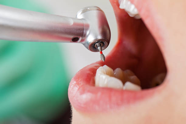Best Cracked Tooth Emergency Dentist  in Jonesville, NC